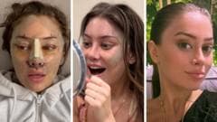 A facelift at 28? Why young people are turning to plastic surgery